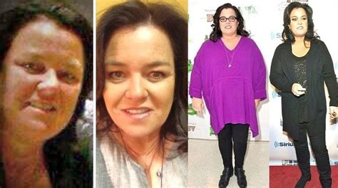 Weight Loss 4 Months After Gastric Sleeve Postsindiano9