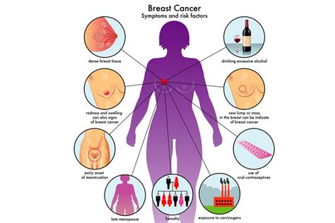 Breast Cancer Symptoms Causes And Prevention Doctor Asky