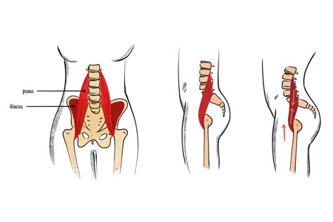 How To Fix Anterior Pelvic Tilt Exercises And Stretches