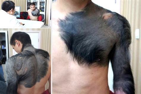 Work Of Nature 10 Rarest Unbelievable Birthmarks That