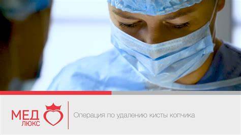 Удаление кисты копчика диета