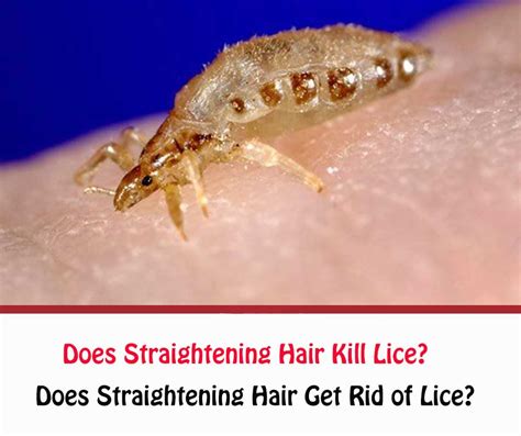 You have to get rid of all the nits. Dead vs Live Nits: What Do Dead Nits Look Like ...
