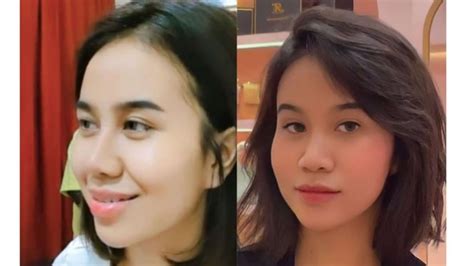 begini hasil hidung baru mayang pasca oplas lebih mancung dan dipuji warganet