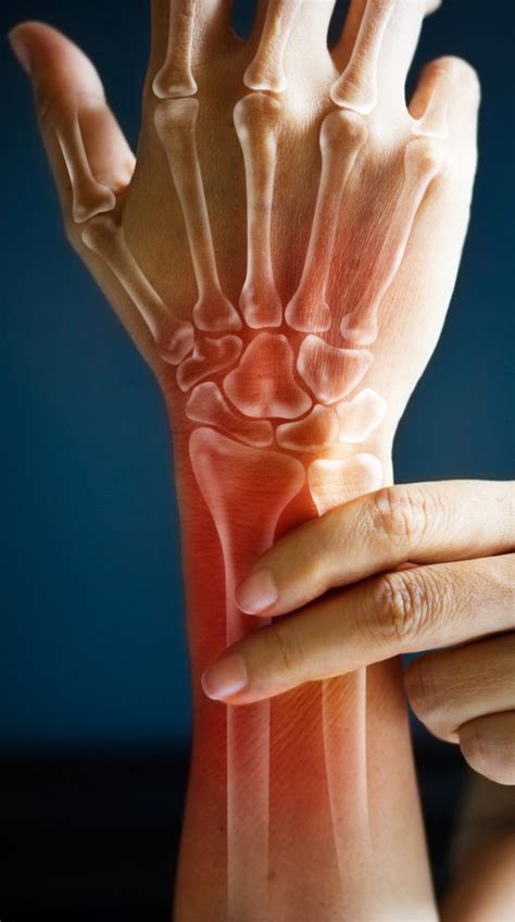 Hand And Wrist Pain Symptoms And Causes West Coast Orthopedics