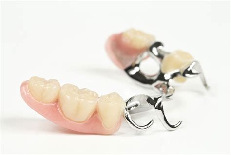 Stark Dental Partielle Prothese Teilprothese