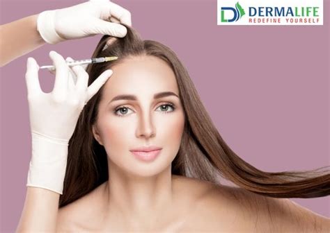 Platelet Rich Plasma Therapy For Hair Loss Dermalife Clinic At Best Price In Delhi