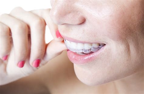 How Invisalign Can Improve Your Smile Laulani Dental Care