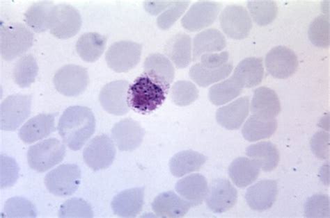 Foto Gratis Microfotografia Maturo Plasmodium Malariae Schizonte