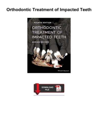 ️pdf⚡️ Orthodontic Treatment Of Impacted Teeth