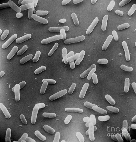 E Coli Bacteria Sem X18000 Photograph By David M Phillips