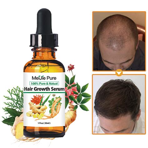 Hair Growth Serum2019 Hair Growth Treatmenthair Serum