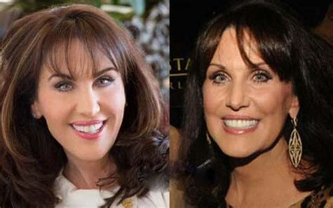 Dr Phil S Wife Robin Mcgraw Plastic Surgery Did She Really Go Under The Knife Glamour Fame