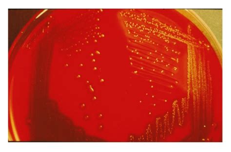 Streptococcus Pyogenes On Agar Hot Sex Picture