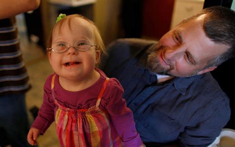 Down Syndrome Treatment Often Requires Traveling