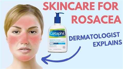 Rosacea Skin Care Dermatologist Review Youtube
