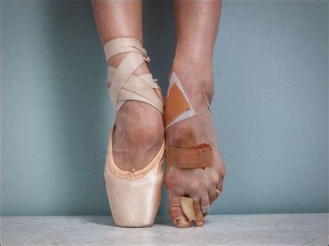 Le Affezioni Più Comuni Del Piede Del Ballerino Danzasi