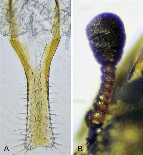 Sternite Ix A And Antenna B Of Anthrenus Dorsatus Mulsant And Rey