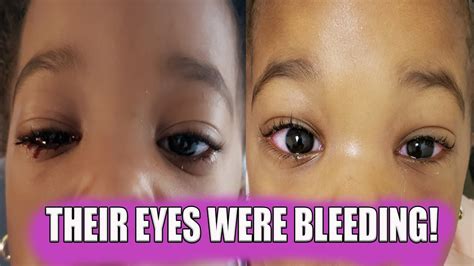 Their Eyes Were Bleeding Vlog Youtube