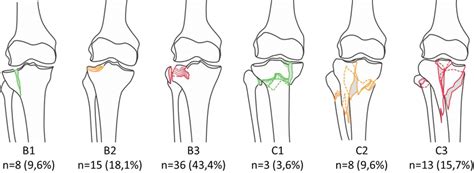 Distribution Of Affected Knee Joints According To The Ao Ota