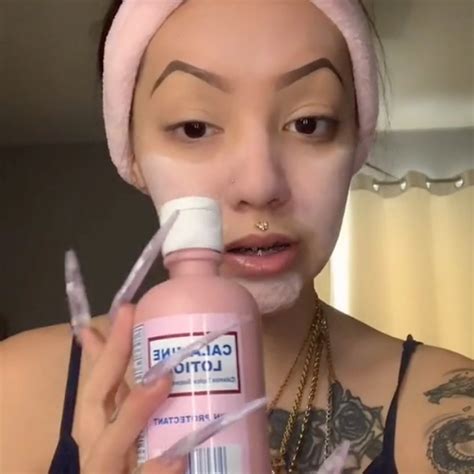 New Tik Tok Trend Gets People Using Calamine Lotion As A Better