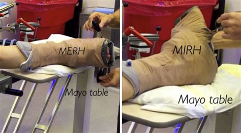 The foot is out of the clamp of the fracture table ...