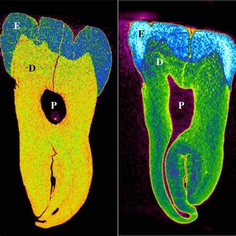 Ct Scans Of Two Different Teeth Showing All Three Major Layers