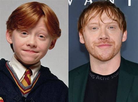 Surprising Images Of Harry Potter Cast Then And Now