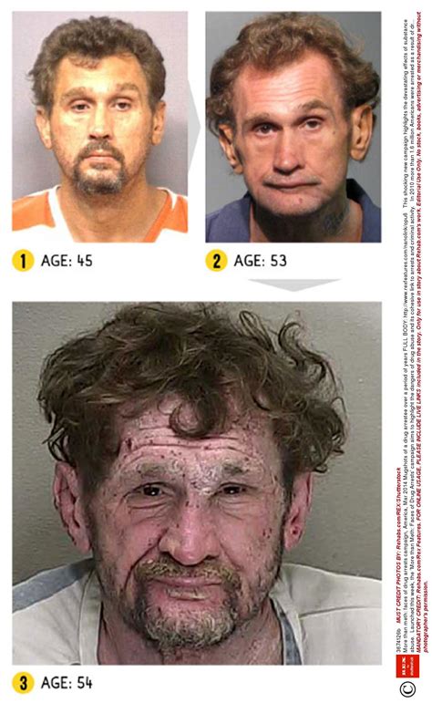 Before And After Pics Of Crystal Meth Users Are Enough To Put You Off