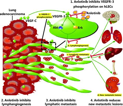 Schematic Presentation Of Suppression Of Lymphatic Metastasis By