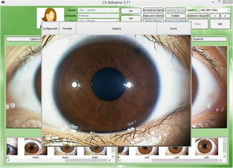 Analizador De Iris Pro De C Mara De Iridolog A Ocular Usb De Mp