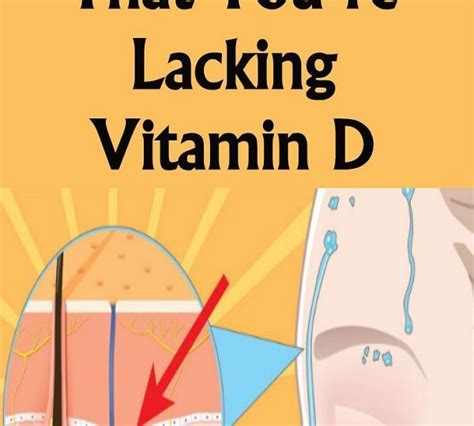 Unusual Signs That Youre Lacking Vitamin D Lifestyle