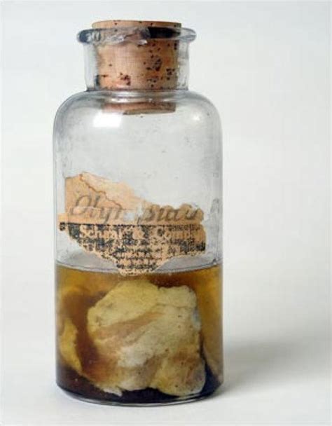 One Of The Preserved Meat From The Kentucky Meat Shower Incident