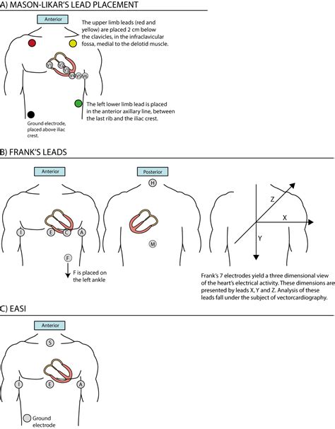 The Ecg Leads Electrodes Limb Leads Chest Precordial Leads 12