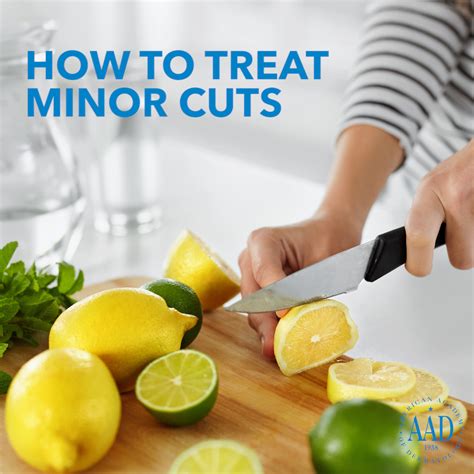 How To Treat Minor Cuts