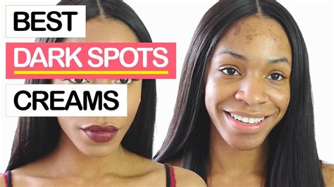 10 Best Dark Spots Removal Creams 2019 Remove All Spots From Your