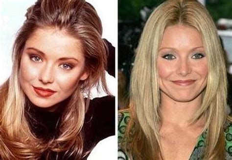 Kelly Ripa Plastic Surgery Before After Pictures Plastic Surgery