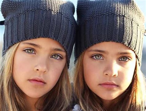 These Twins Were Named “the Worlds Most Beautiful” A Decade Ago Wait