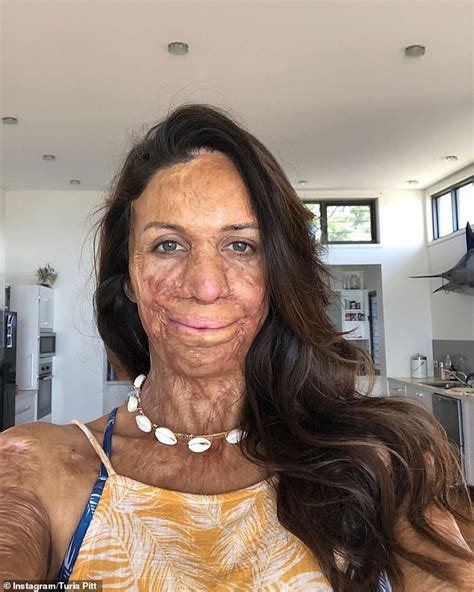 Turia Pitt Thanks Her Supporters For Giving Her Their Most Precious Resource Daily Mail Online