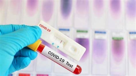 Syarat syarat menjadi warga negara indonesia. 7 Fakta Rapid Test Antigen yang Menjadi Syarat Baru Keluar Masuk...