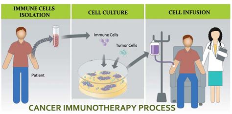 Cancer Treatment In India Cancer Cell Immunotherapy In India