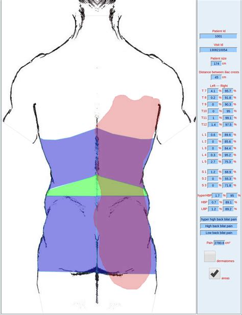 When to see a doctor. Example of a painful surface area (red) distributed in several back... | Download Scientific Diagram