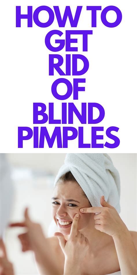 How To Get Rid Of Blind Pimples Stylish Life For Moms Blind Pimple