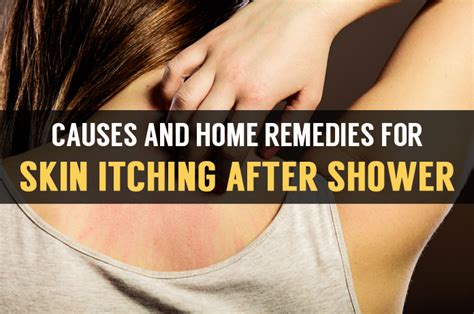 Learn Cause Of Skin Itching After Shower With Natural Home Treatment