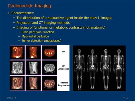 Ppt Nuclear Medicine Imaging Powerpoint Presentation Free Download