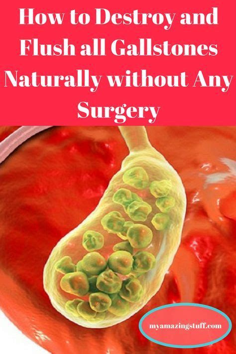 Sometimes the gallbladder fails to work properly, and can become filled with gallstones. How to Destroy and Flush all Gallstones Naturally without ...