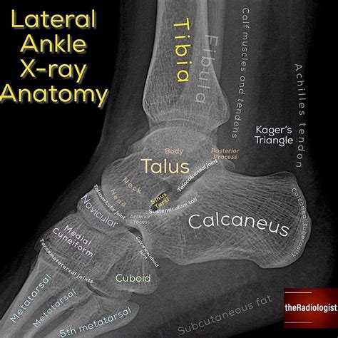 Lateral Ankle X Ray Anatomy