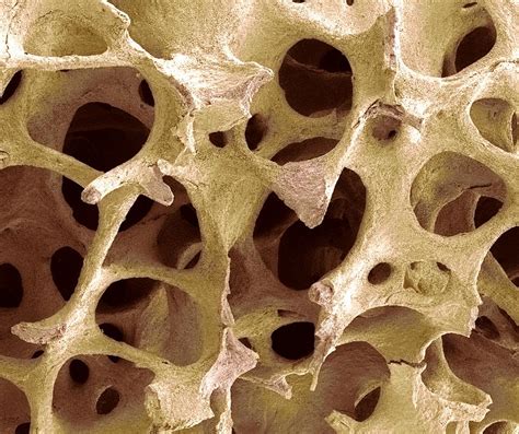 Bone Tissue Sem Photograph By Steve Gschmeissner Pixels