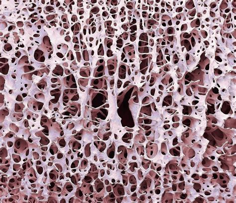 Bone Tissue Photograph By Steve Gschmeissner Fine Art America