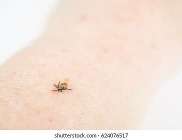 Living Tick On Naked Skin Person Stock Photo Shutterstock