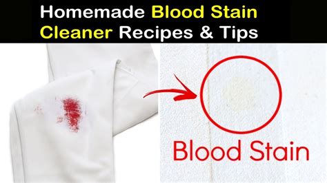 Remove Old And Dried Blood Stains From Clothes Blanket Bed Mattress